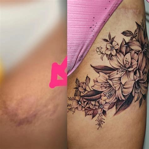 33 Tattoo To Cover Scars Ideas You Will Love
