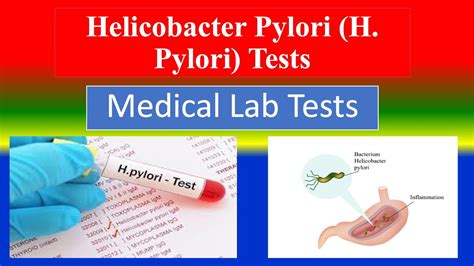 H Pylori Lab Test: Quick, Accurate Detection Guide