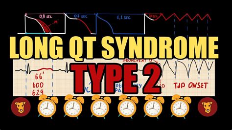 Convert Liters to Quarts Effortlessly: Accurate l to qt Conversion Guide