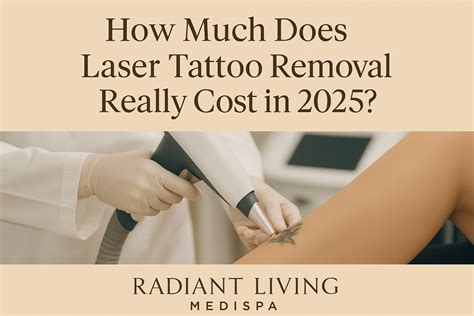Laser Tattoo Removal Cost In 2025 Radiant Living