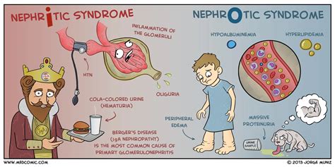 Nephrotic vs Nephrotic Syndrome: Key Differences