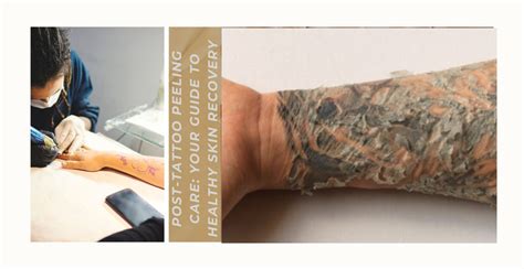 Post Tattoo Peeling Care Your Guide To Healthy Skin Recovery Clinikally