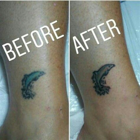 Touched Up This Older Tattoo Before And After Photo Touch Up Tattoo
