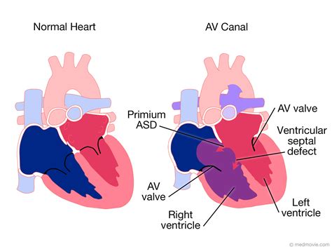 What Is Av Gross At April Langdon Blog